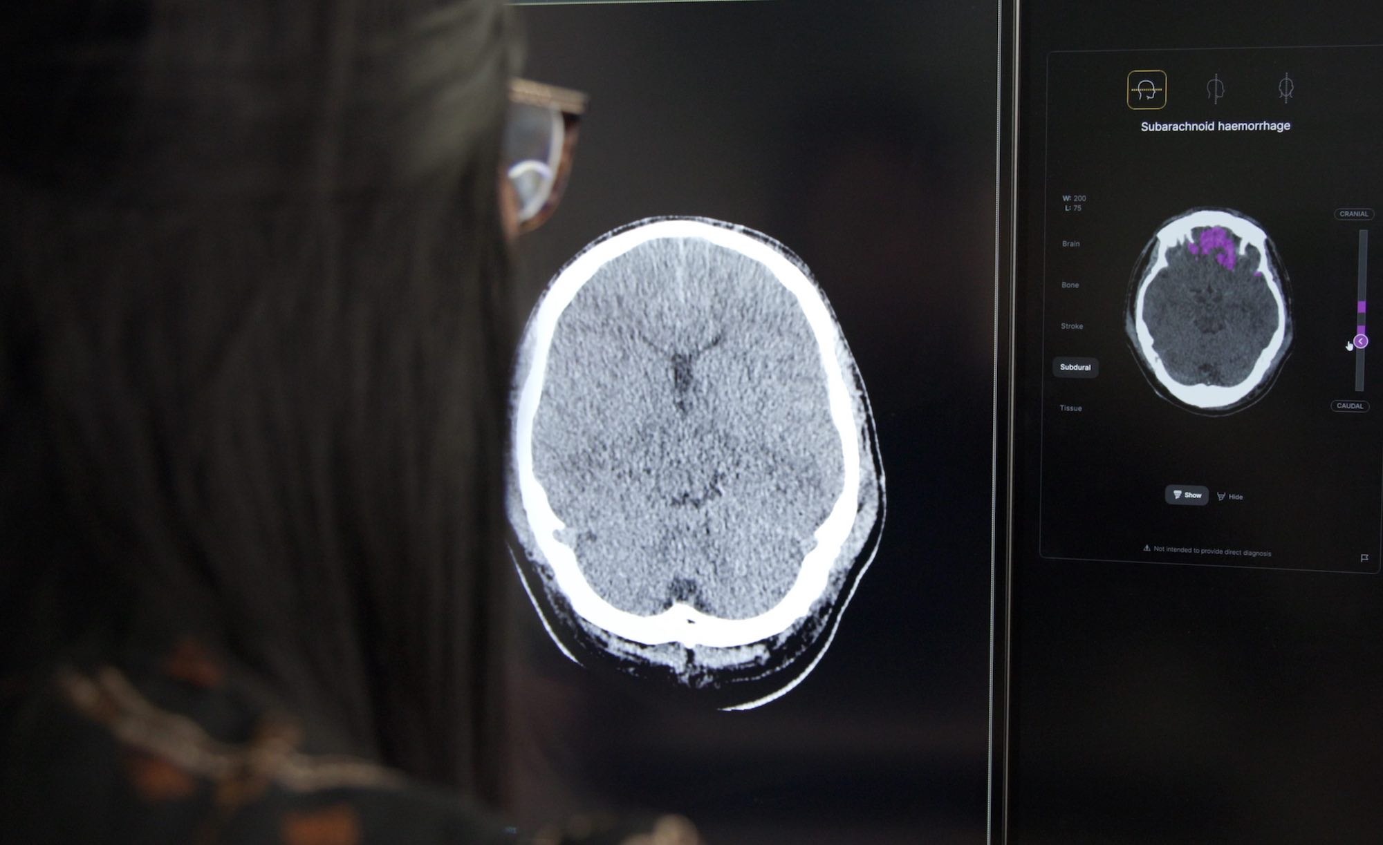 Annalise Enterprise: decision-support AI for medical imaging